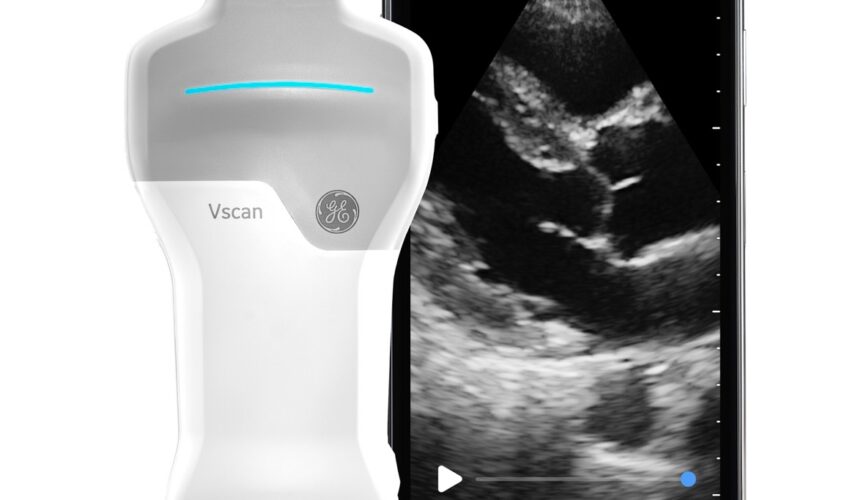 GE Vscan 超音波エコー Dualドゥアルプローブ ポータブルエコー  